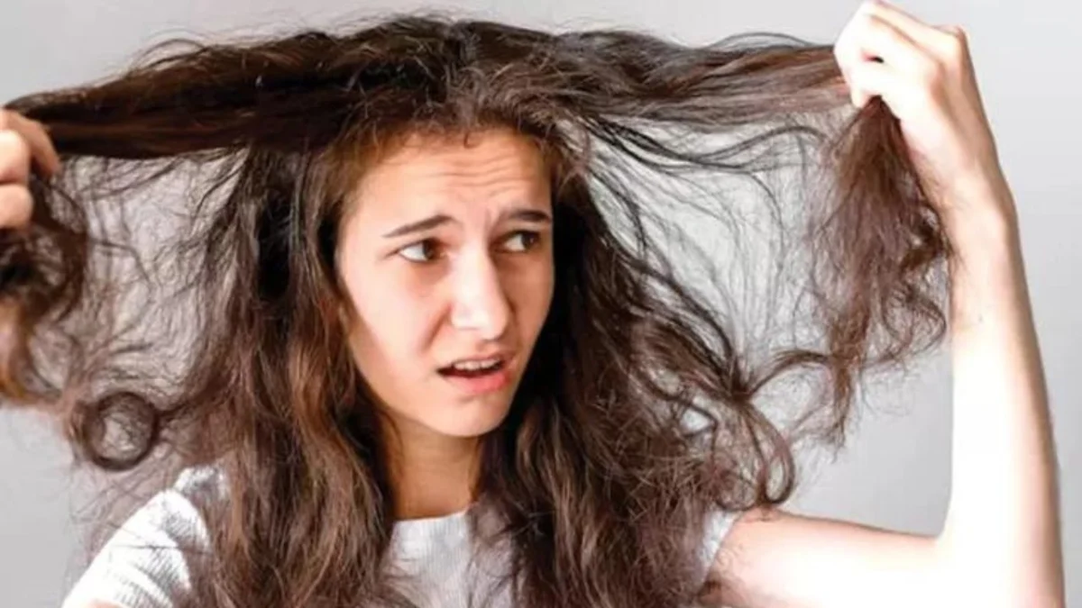 Rambut Rontok? Begini Cara Merawat Rambut agar Tidak Semakin Rusak