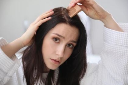 Cara Menghilangkan Ketombe Dari Rambut Dengan Cara, Cek Disini