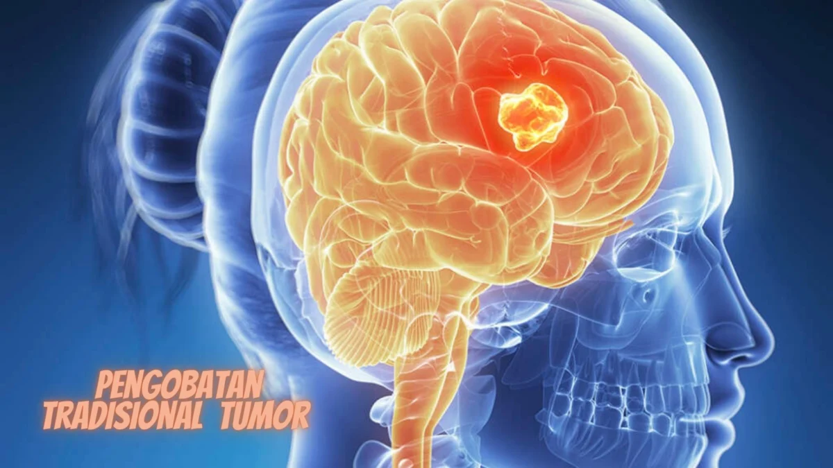 Metode Pengobatan Tradisional untuk Tumor